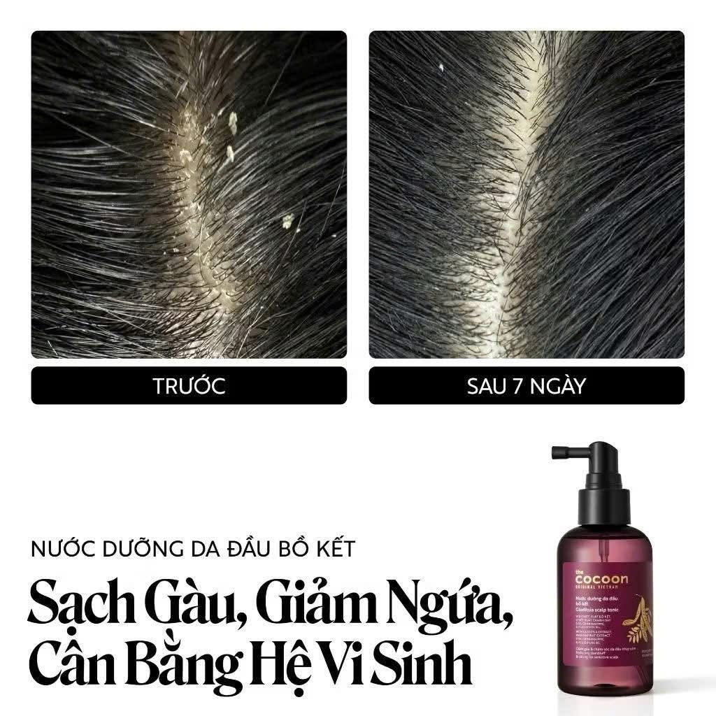 Có sẵn | Nước dưỡng da đầu bồ kết Cocoon
