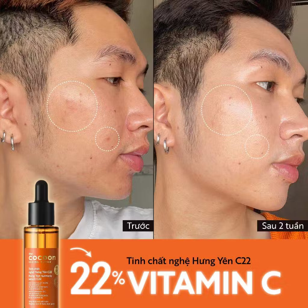 ￼Tinh chất nghệ Hưng Yên C22 (serum) với 22% vitamin C sáng da chuyên sâu & mờ vết thâm Cocoon 30ml